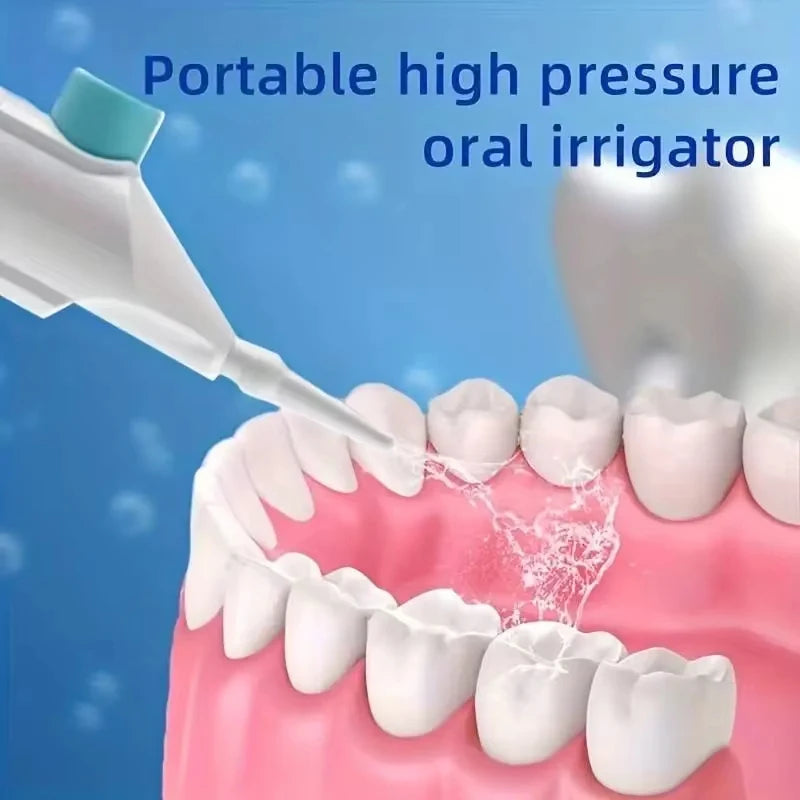 Household High Pressure Oral Irrigator – Portable Water Flosser for Teeth Cleaning